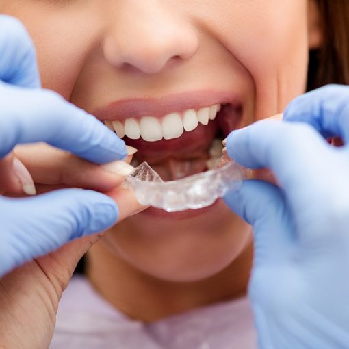 Les 5 meilleurs livres d’orthodontie