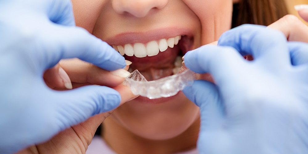 Les 5 meilleurs livres d’orthodontie