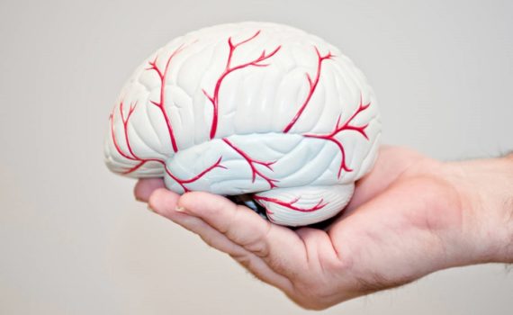 Les 5 meilleurs livres sur l’AVC (Accident Vasculaire Cérébral)