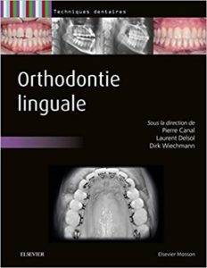 Orthodontie linguale (Pierre Canal, Laurent Delsol, Dirk Wiechmann)