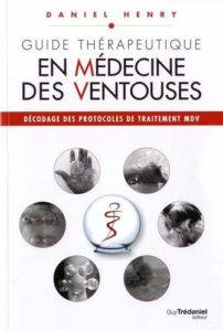 Guide thérapeutique en médecine des ventouses (Daniel Henry)