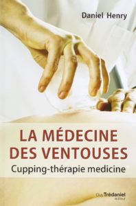 La médecine des ventouses - Cupping-thérapie medicine (Daniel Henry)